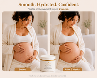 Pure Leaf Essentials Stretch Mark Defense Cream