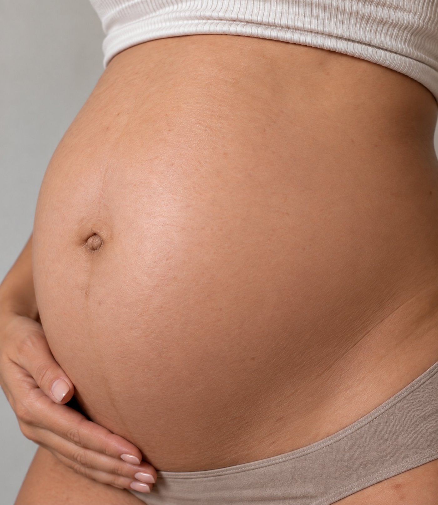 Customer belly after 8 weeks — stretch marks visibly faded